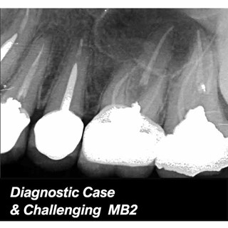 Diagnostic Case & Challenging  MB2