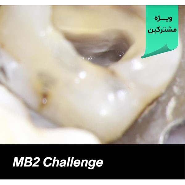 MB2 Challenge